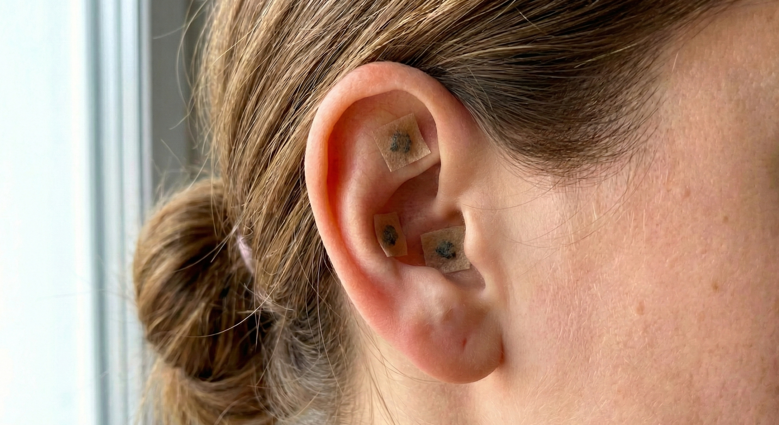 ear-seeds-graines-auriculaires.jpg ear seeds graines auriculaires.jpg