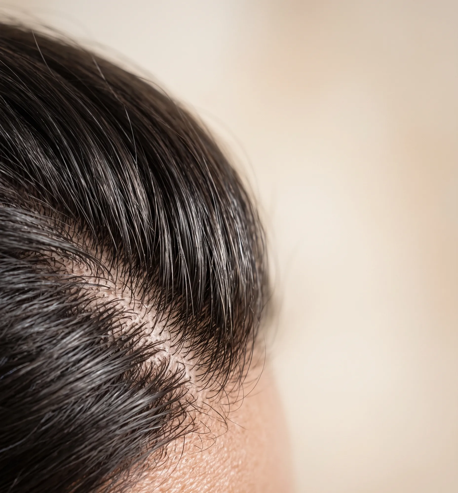 macro détaillée de la texture capillaire et du cuir chevelu sous un éclairage doux et professionnel